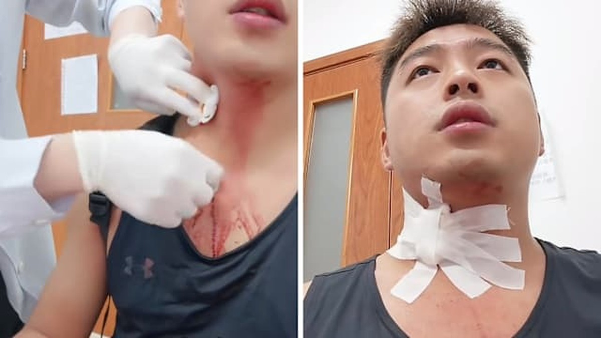 Hậu Quả Khó Lường Từ Một Cú Đập Muỗi: Cảnh Báo Về An Toàn Sức Khỏe